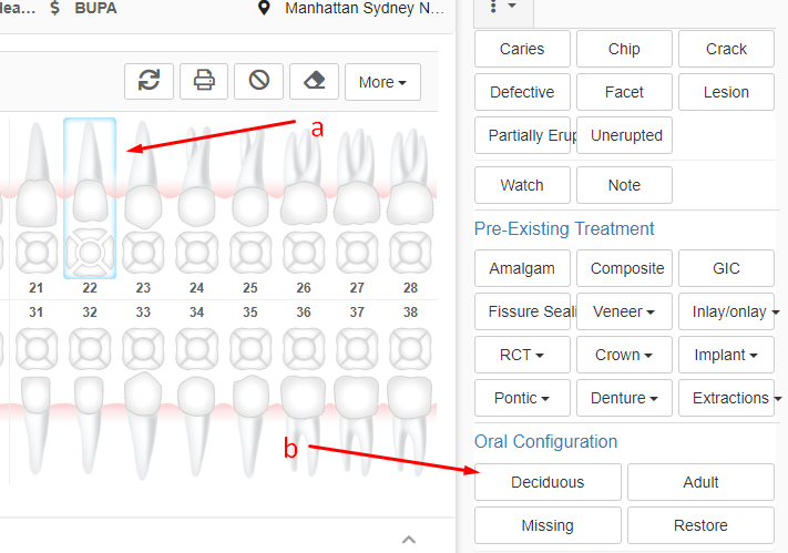 How to chart mixed dentition – Core Practice